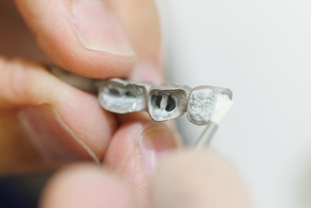 株式会社プロスデンタルラボラトリー様の撮影