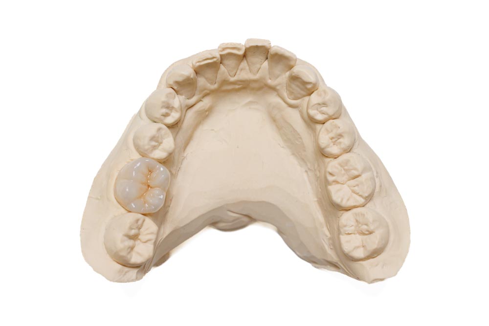 株式会社プロスデンタルラボラトリー様の撮影